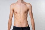 Cara Menjadi Kurus dengan Cepat dan Sehat Panduan Lengkap 2023